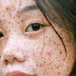 Brunch Spots - Close-Up Photography Of Woman's Face With Freckles