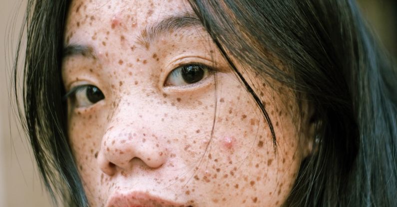 Brunch Spots - Close-Up Photography Of Woman's Face With Freckles